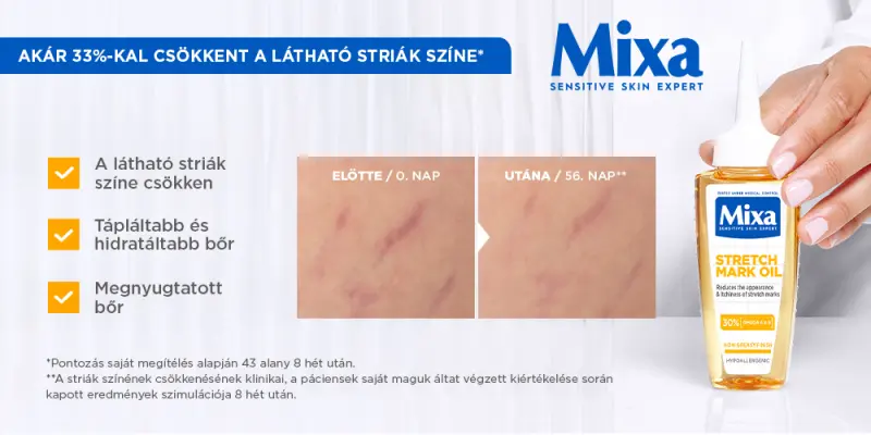 Bőrmegújító hatás: A Mixa Striák Elleni Olaj Bőrmegújító hatás: A Mixa Striák Elleni Olaj