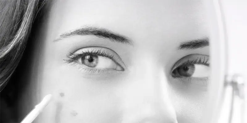 Hiperpigmentáció: mit jelent – És hogyan ismerhetjük fel? Hiperpigmentáció: mit jelent – És hogyan ismerhetjük fel?